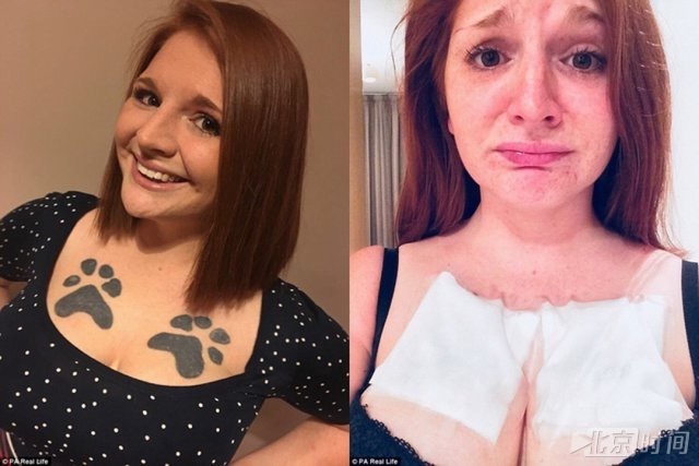 女子因胸前纹爱犬爪印沦为单身狗十年 女子因胸前纹爱犬爪印沦为单身狗十年