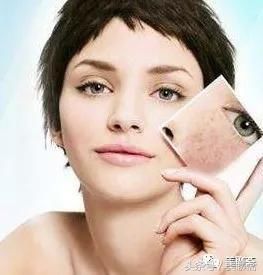 祛除黄褐斑可以不做激光手术!做好这2点就够了