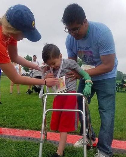 可怜!4岁男孩从轻微发烧演变到截肢 医生至今