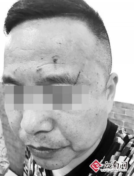 云南一医院领导打医生 院方:打人者已被停职解聘 云南一医院领导打医生 院方:打人者已被停职解聘