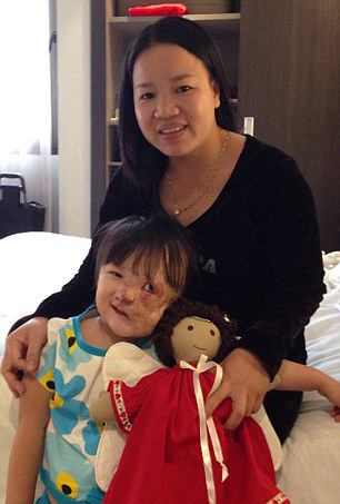 越南5岁女童患致命肿瘤 半张脸被肉瘤覆盖 越南5岁女童患致命肿瘤 半张脸被肉瘤覆盖