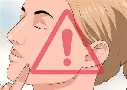 郑爽直播教大家挤痘痘,到底怎么挤才不会留疤