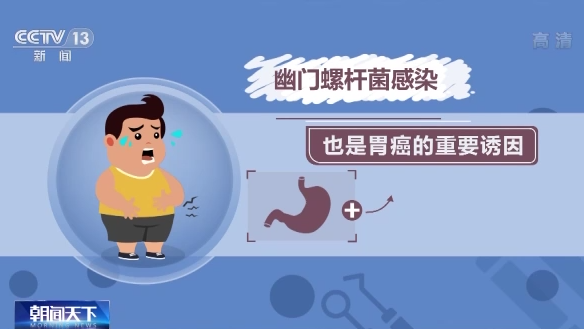 全国肿瘤防治宣传周 消化道肿瘤能否实现早诊早治？