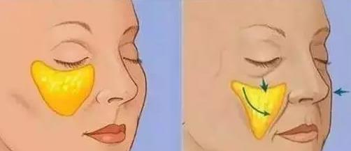 美美的杨紫胖迪苹果肌下垂这样太显老了!