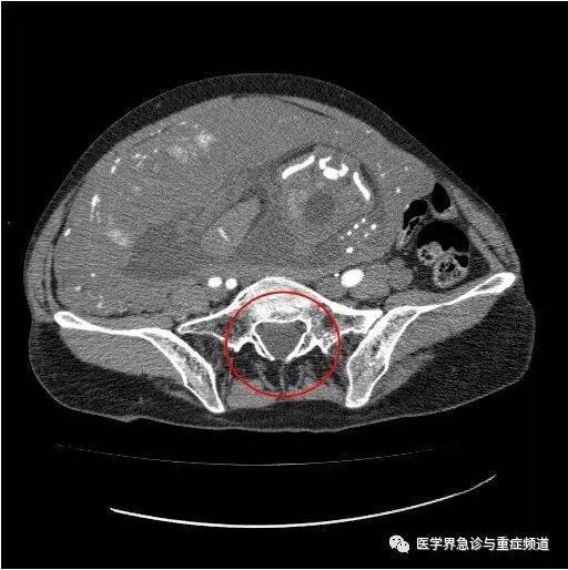 危急情况下,孕妇也要做ct!