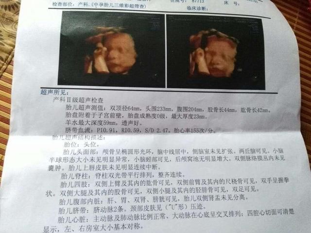 怀孕三个月已成人形的宝宝 做彩超怎么分辨男