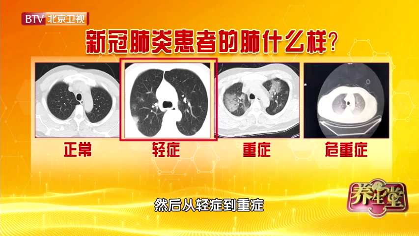 新冠肺炎患者的肺是什么样的