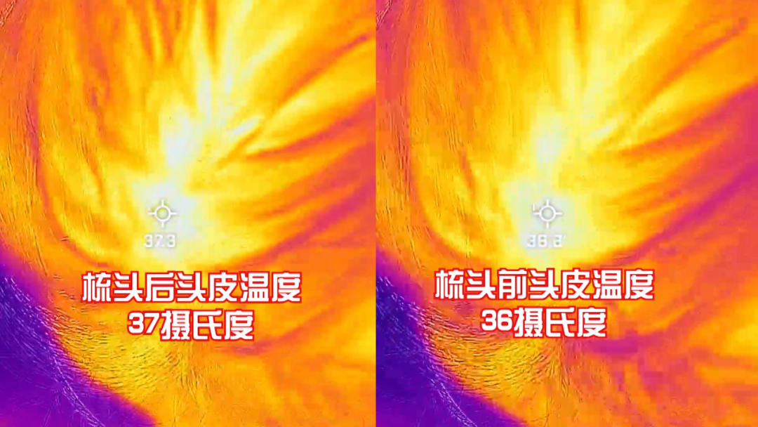 s8怎么保养【我是大医生】头皮保养 年轻的“头等”秘诀！_北京时间_https://www.jmylbn.com_新闻资讯_第14张
