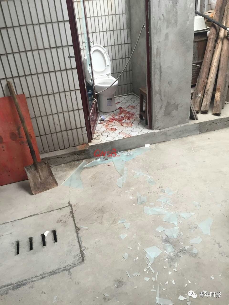 男孩卫生间摔跤肠子掉出 流了全身三分之一血