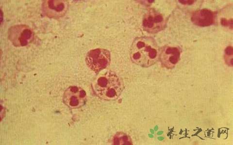淋病奈瑟菌会引起什么疾病