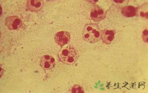 淋病奈瑟菌会引起什么疾病