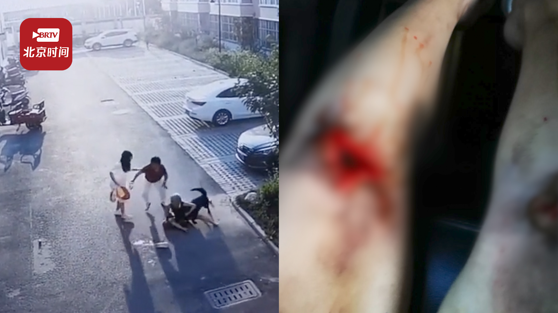 女主人为保护泰迪被未牵绳德牧咬伤: 不救后果不堪设想，德牧主人赔偿3000元