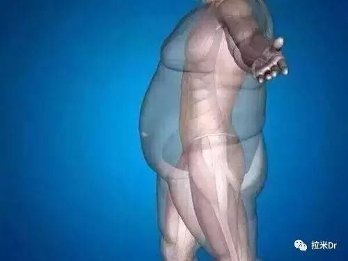 HIV与慢性病:脂肪代谢障碍