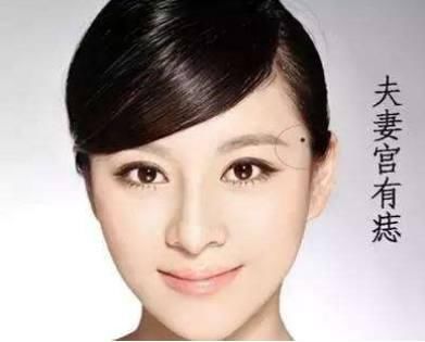 算命先生说:此处有吉痣,天生的富贵命,注定多财