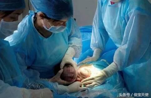 丈夫粗心竟导致孕妇产后流血七天,结果导致产