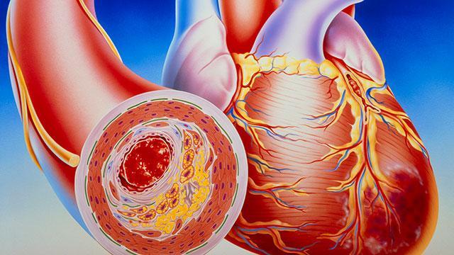 《养生堂》20170320春季巧养心 《养生堂》20170320春季巧养心