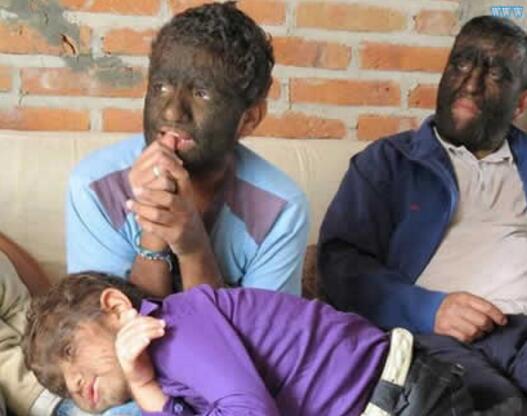 世界上毛最多的人 墨西哥狼人家族 世界上毛最多的人 墨西哥狼人家族