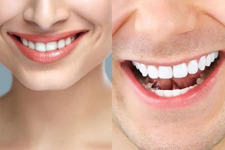 【图】矫正牙齿会改变脸型吗 带你了解真相