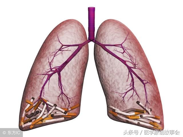 哪些人应该定期检查肺部CT,肺病变的三种症状