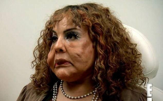 韩国女星整容失败,鼻子像塑料做的,还能用鼻孔