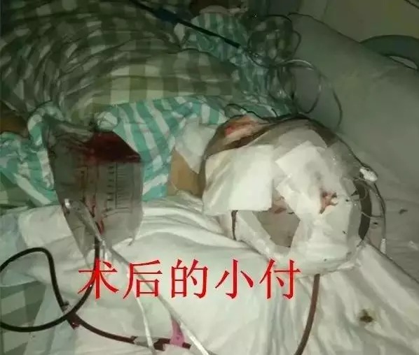 男子疑爱车被划 用铁锤砸碎13岁男孩脑壳致昏迷