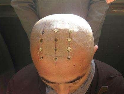 古代和尚为什么要烧几个戒疤? 现在为什么都没有了?