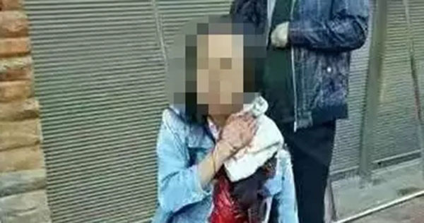 七夕夜云南大理一男子持刀当街砍伤3人 已被抓获 七夕夜云南大理一男子持刀当街砍伤3人 已被抓获