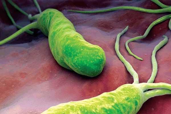 医生说杀灭幽门螺杆菌有七种药物组合,一种小