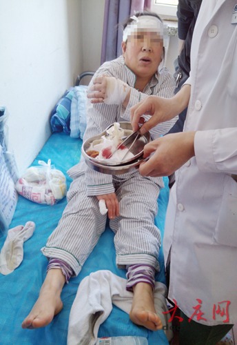 大庆市一饭店爆炸造成14人受伤 威力巨大震碎6楼玻璃(图)