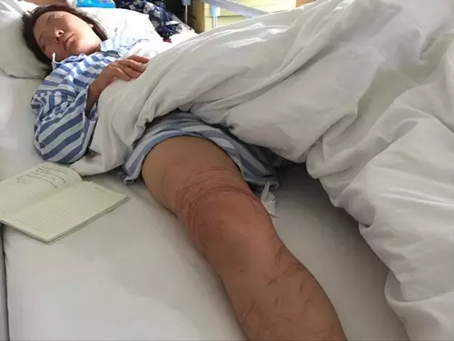 大连部分海域出现海蜇 曾有女童被蛰身亡 - 周公乐 - xinhua8848 的博客 大连部分海域出现海蜇 曾有女童被蛰身亡 - 周公乐 - xinhua8848 的博客