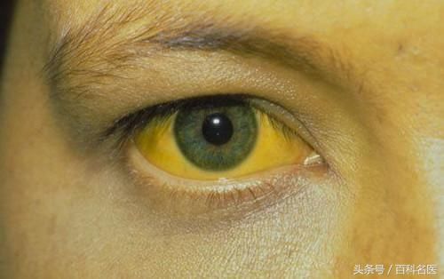 外卖员患乙肝不能应聘?日常接触乙肝患者会不