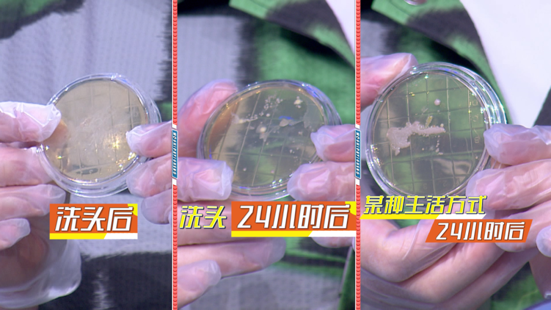 s8怎么保养【我是大医生】头皮保养 年轻的“头等”秘诀！_北京时间_https://www.jmylbn.com_新闻资讯_第8张