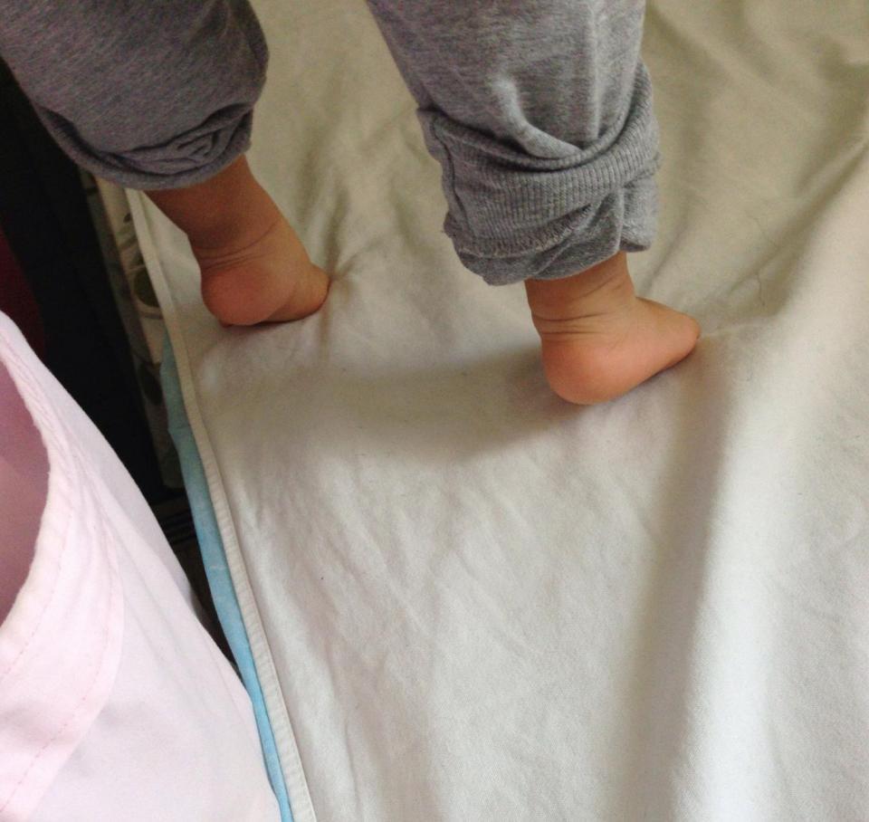 正常婴儿的足背屈图片图片