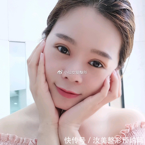 开内眼角前后对比照片,不灵不灵的大眼睛也着