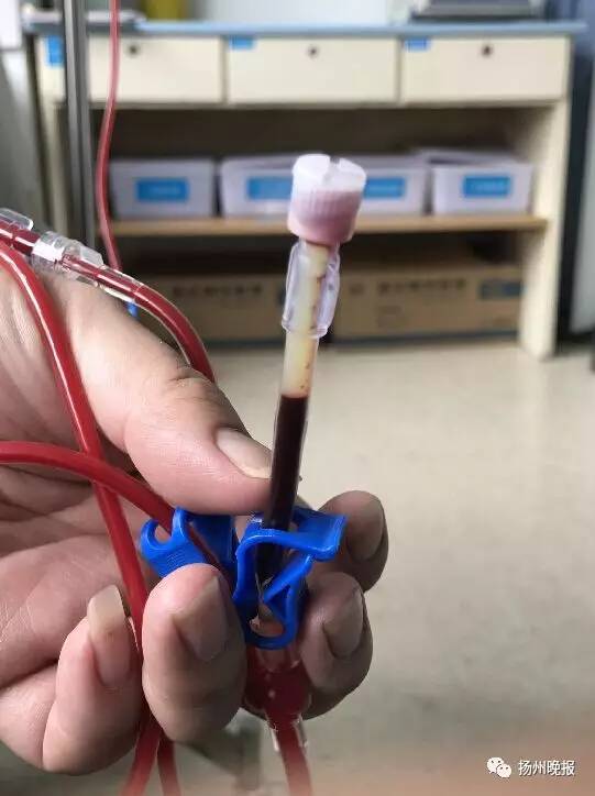 扬州一男子突然暴瘦60斤,体内抽出牛奶血!致