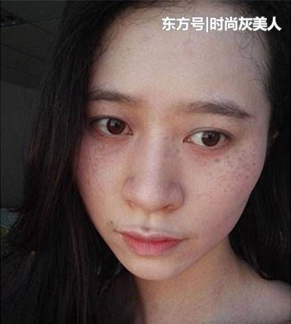 脸上大片斑点不见了,睡前涂点它,淡斑美白,皮肤透亮光滑