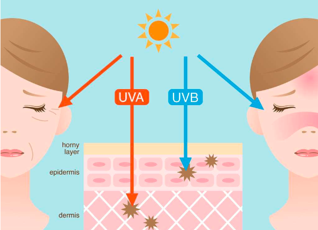 怎样治疗紫外线过敏,选对方法很重要