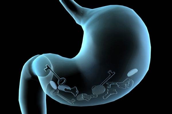 从幽门螺杆菌感染到胃癌需要多长时间?