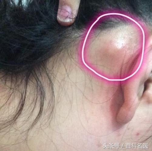 春火来势汹汹,教你几招轻松浇灭"春火"