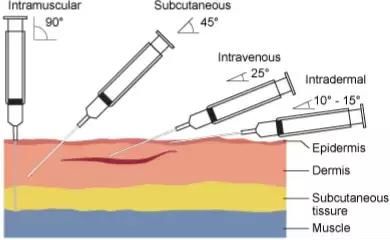 新护士皮内注射常见的几个错误,你有过吗?