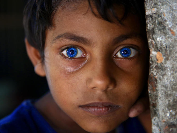 男孩长有一双罕见的蓝色瞳孔,很像美剧《权力的游戏》中的异鬼眼睛