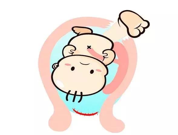 月经十天没干净可能是子宫憩室,有剖宫产史者