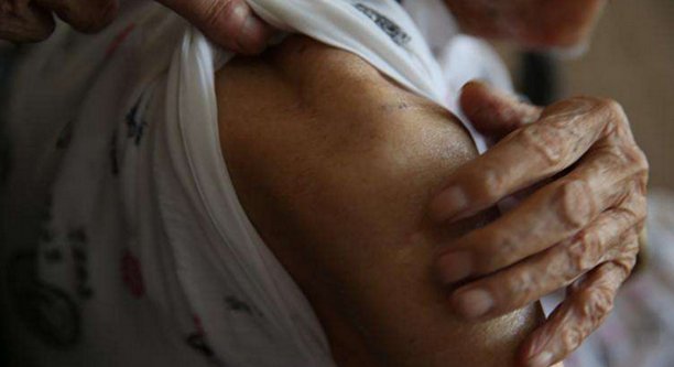 老兵身上的伤痕,伴随一生的疼痛,如同伴随一生的战争记忆