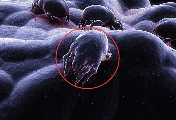 多功能的液状,洗脸,脸上的螨虫奇妙消失!痘痘