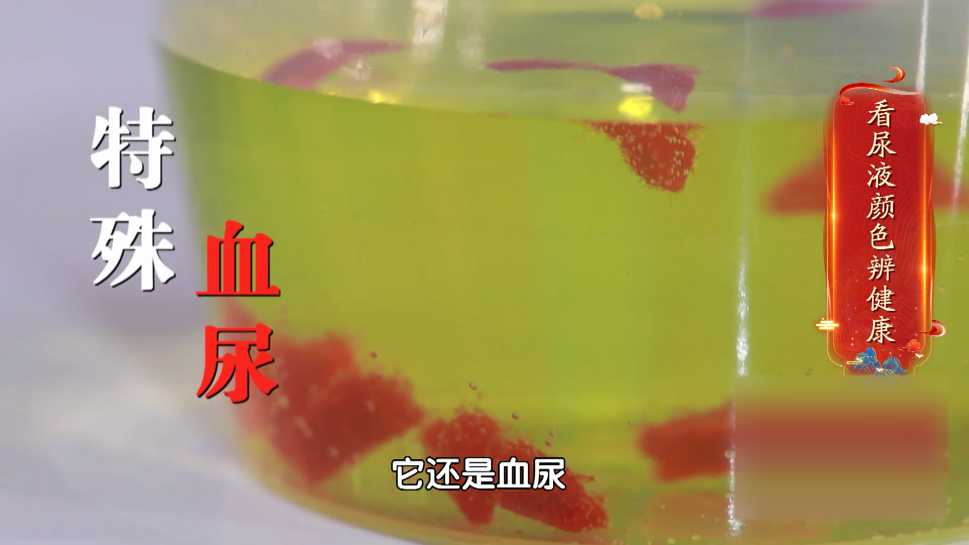 看尿液颜色辨健康,出现血尿别忽视!_北京时间