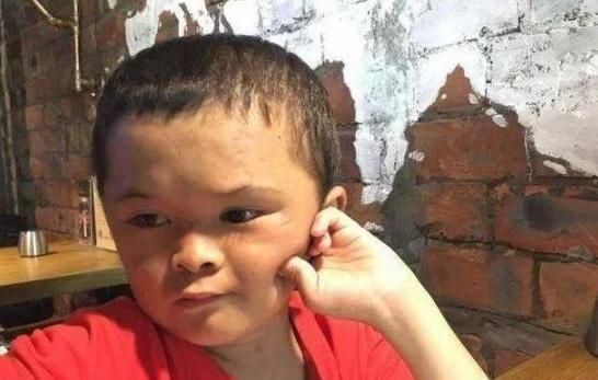 当年爆红的小马云,身价暴涨,出门身边大群人伺