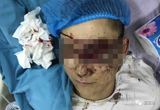 女司机鸣了声喇叭 遭12名醉酒保安持钢管围殴 女司机鸣了声喇叭 遭12名醉酒保安持钢管围殴