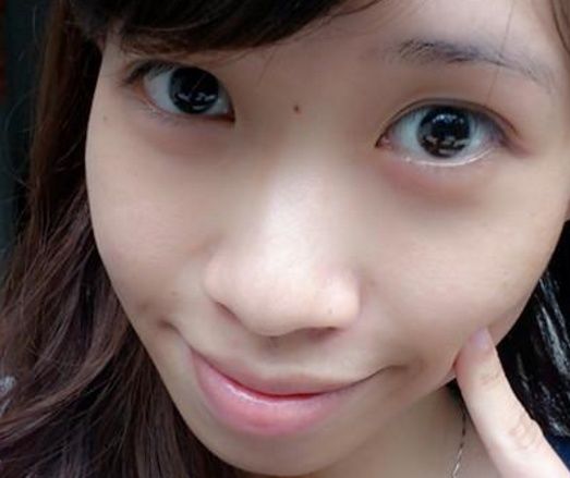 白醋泡上它瓦解黑色素,大妈拿来涂脸,七天淡斑