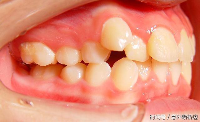 大学教授谈二战日本败因:只因日本人牙齿不齐
