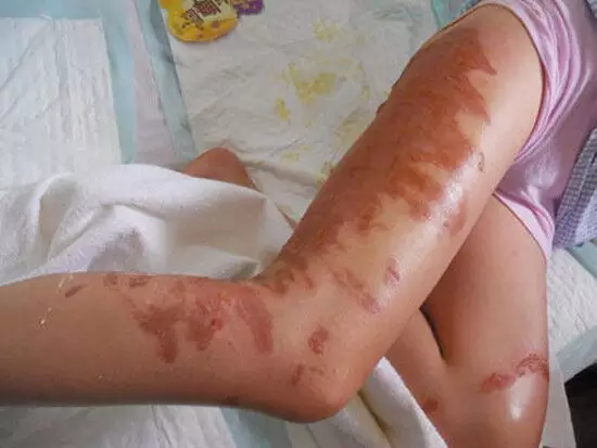 大连部分海域出现海蜇 曾有女童被蛰身亡 - 周公乐 - xinhua8848 的博客 大连部分海域出现海蜇 曾有女童被蛰身亡 - 周公乐 - xinhua8848 的博客